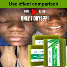 Aloe Vera Whitening Soap, Remove Acne, Spots, Skin Radiant, Improve Skin Luster, Vegan Bath Wash for All Skin Types, 200g